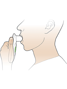 Three-step process for conducting an FEV1 test: Insert mouthpiece and switch on device, instruct patient to exhale 3 times, record best result.