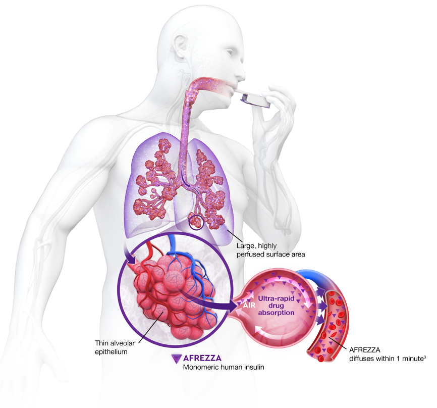 Anatomical illustration of man inhaling AFREZZA and the movement of microparticles through the lungs, where insulin is released, rapidly reaching systemic circulation.