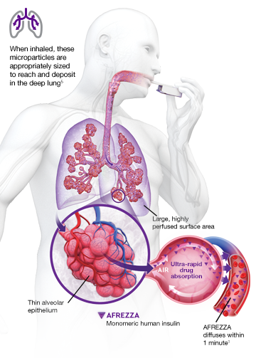 Anatomical illustration of man inhaling AFREZZA and the movement of microparticles through the lungs, where insulin is released, rapidly reaching systemic circulation.