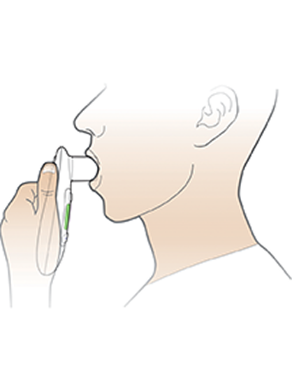 FEV1 spirometry test Step 2: patient exhaling forcefully 3 times